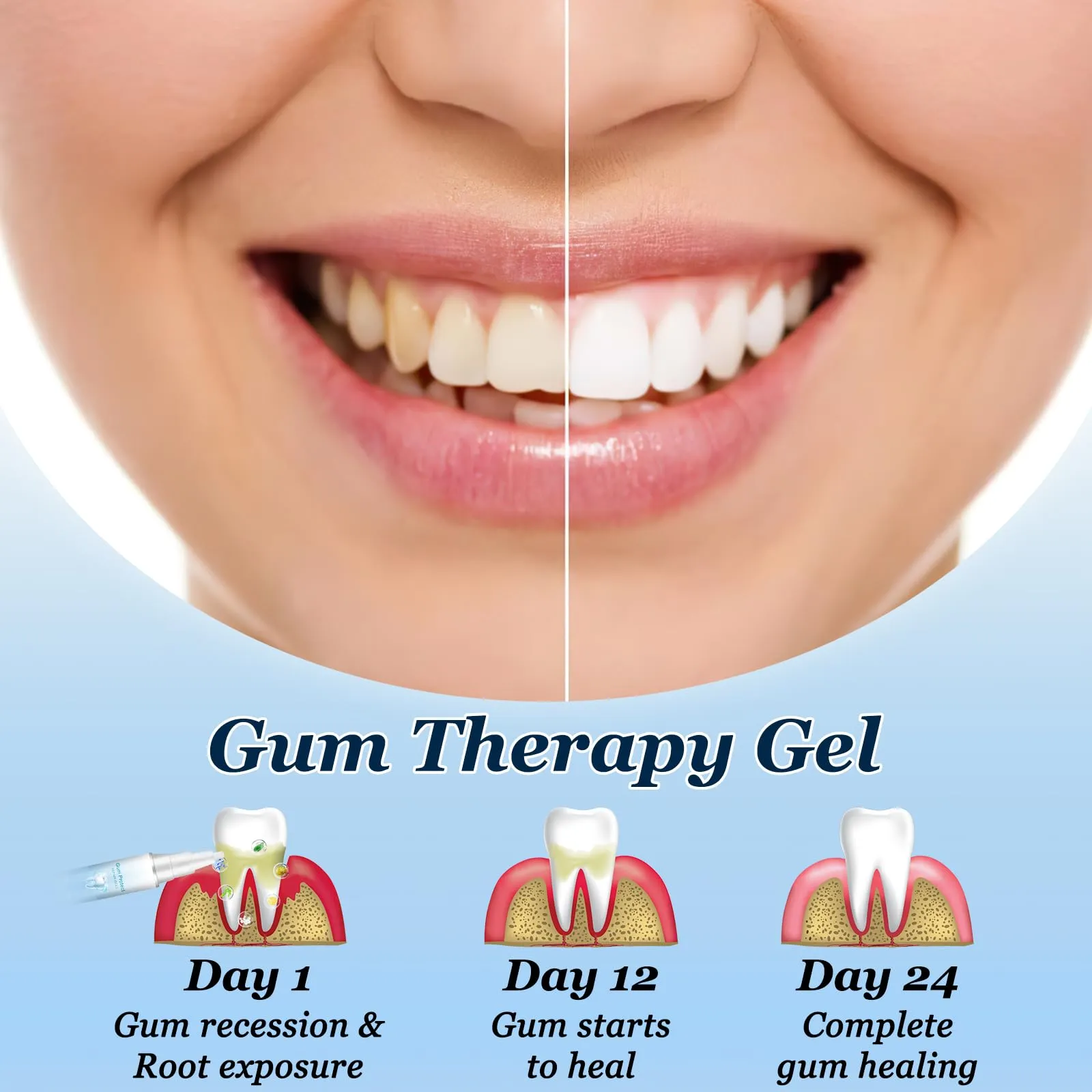 2024 Neslemy™ Gum Shield Therapy Gel, Neslemy Gum Gel, Dentizen Gum Therapy Gel,Gum Instant Treatment Gel,Tooth Whitening Pen Deep Cleaning Stains and Tartar Oral Care(3Pcs)