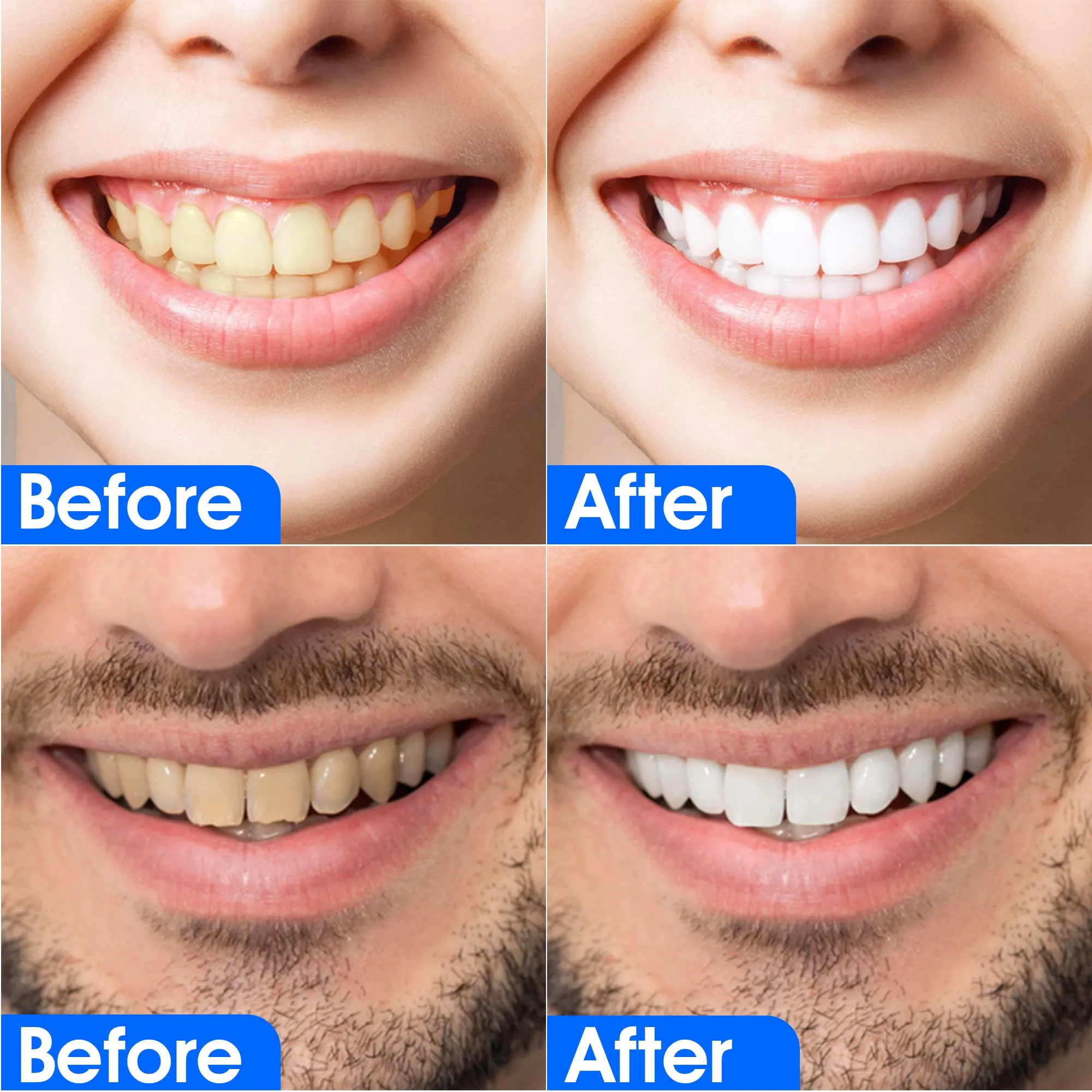3D Teeth Whitening Strips 28 Pcs -Non Sensitive- Mint Flavor-Teeth Whitening Kit Advanced Teeth Whitener Strips Whitening Teeth Tooth Whitening Strips for White Teeth