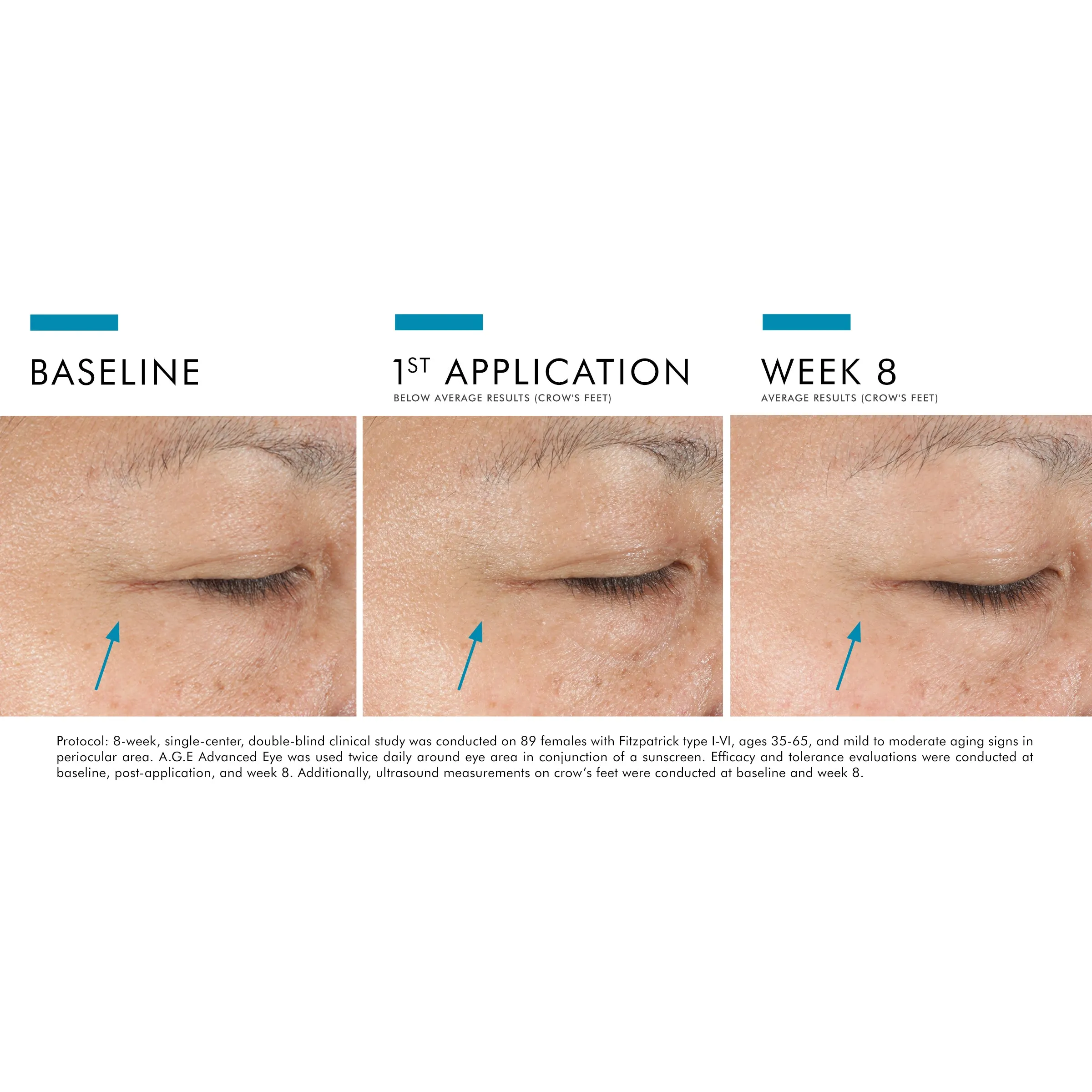 A.G.E. Advanced Eye 15ml