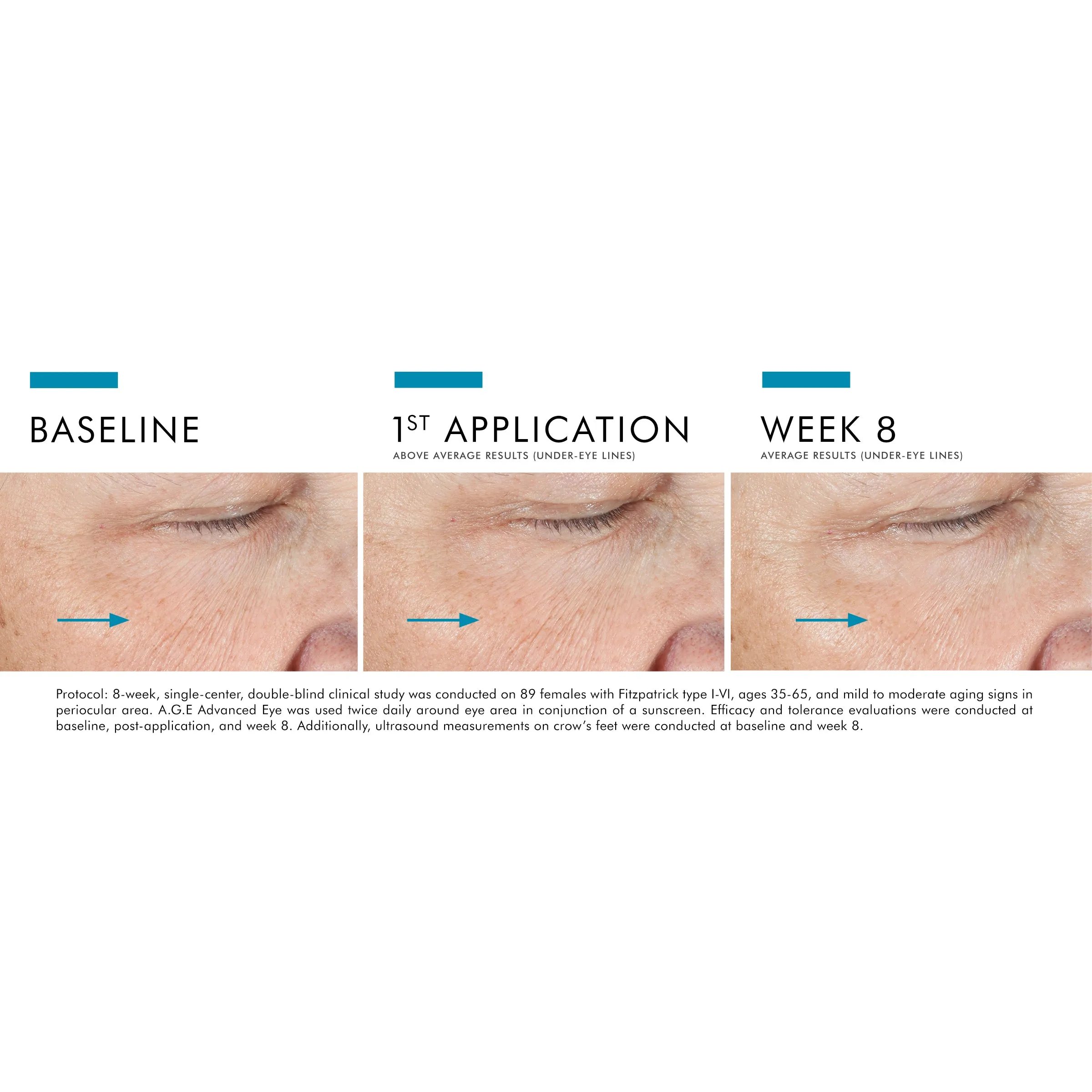 A.G.E. Advanced Eye 15ml