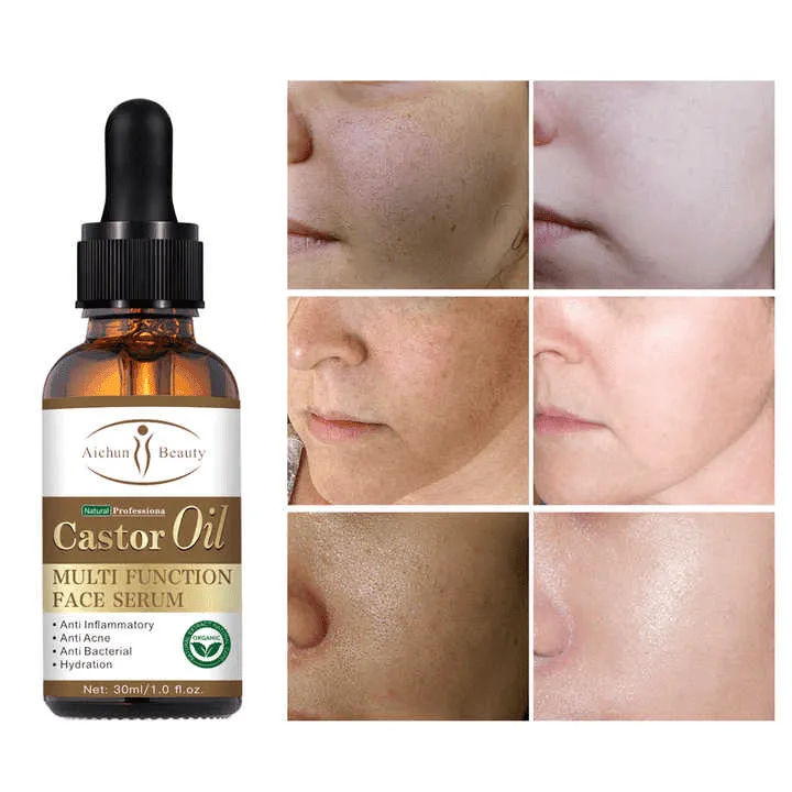 Aichun Beauty Whitening Moisturizing Castor Oil Face Serum - 30ml