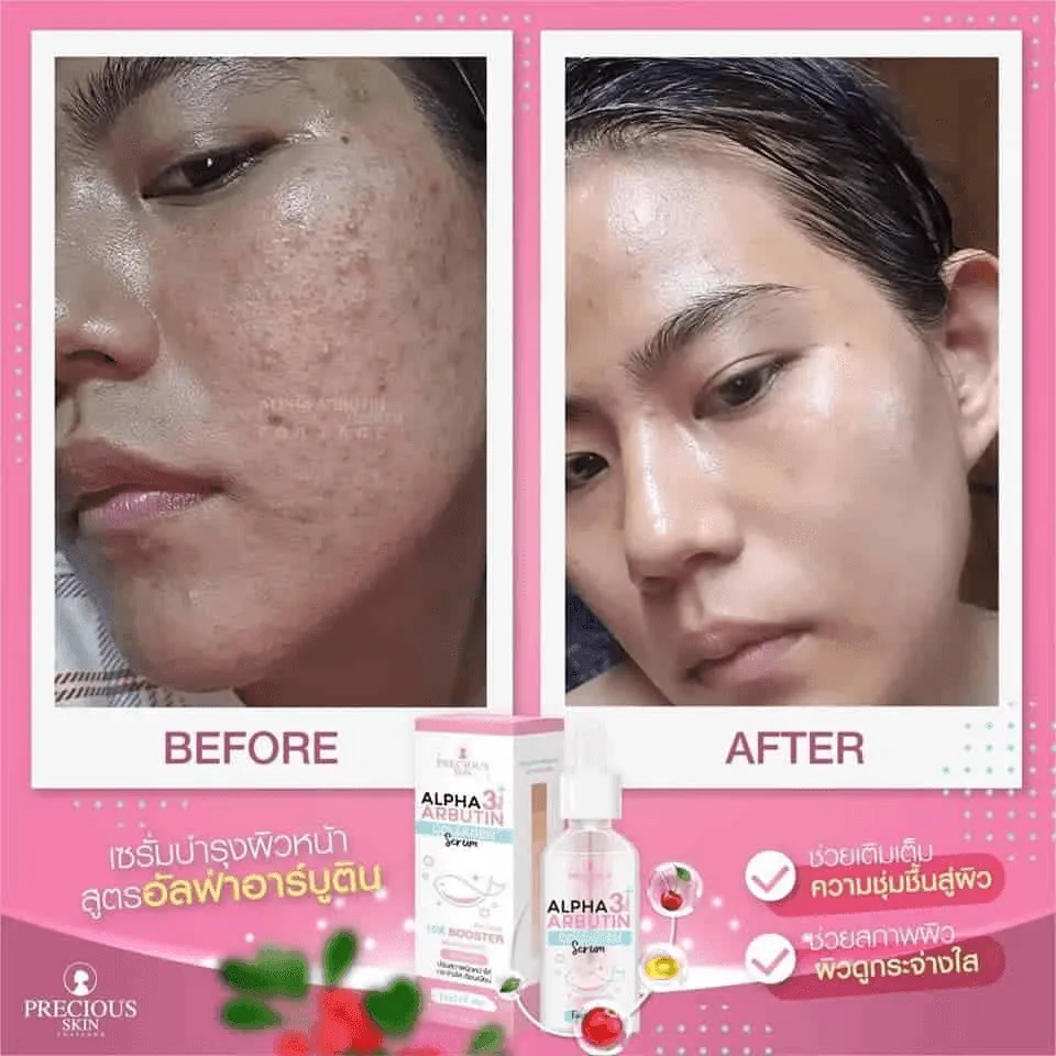 Alpha Arbutin Whitening Facial Serum - 50ml