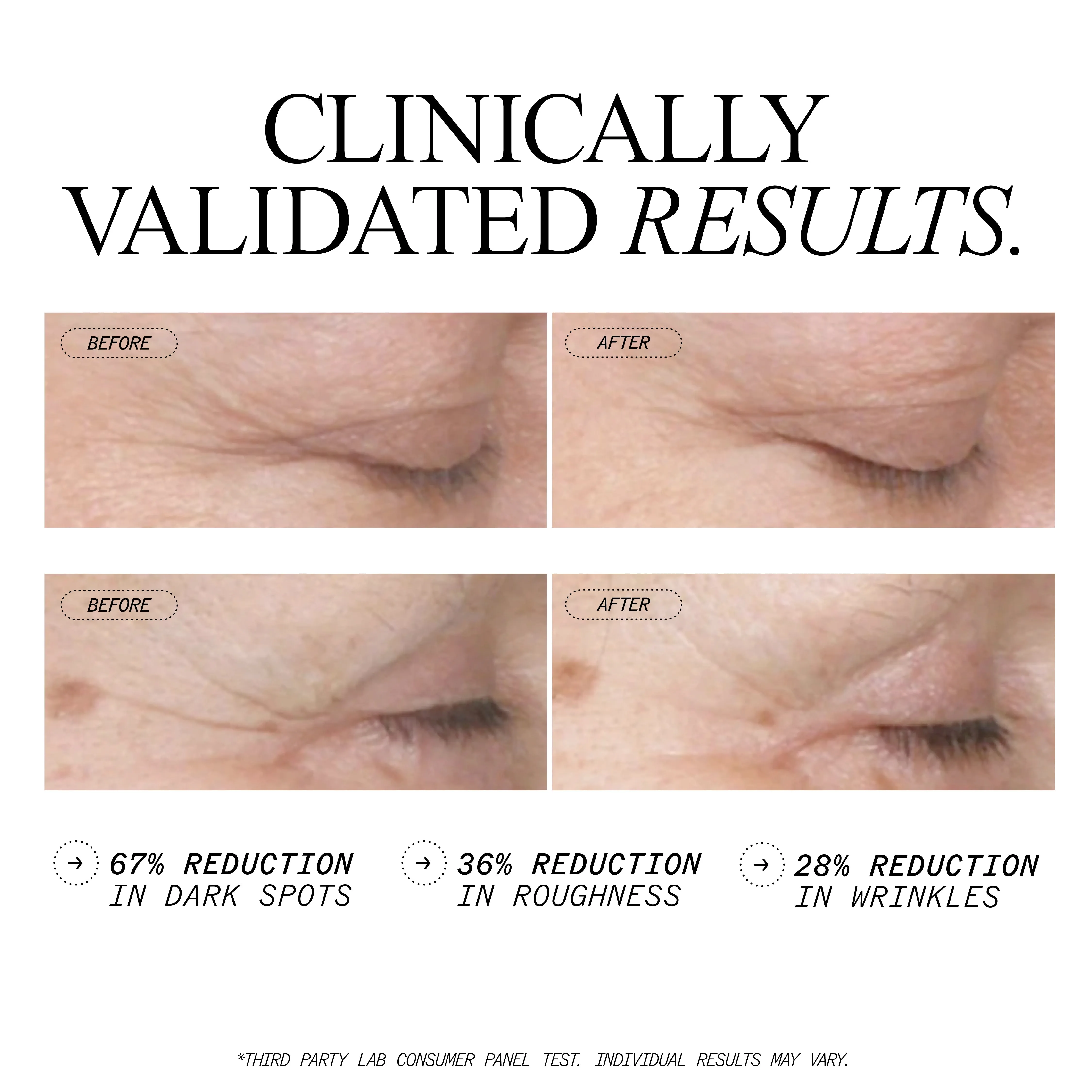 Anti-Wrinkle Retinol Overnight Serum