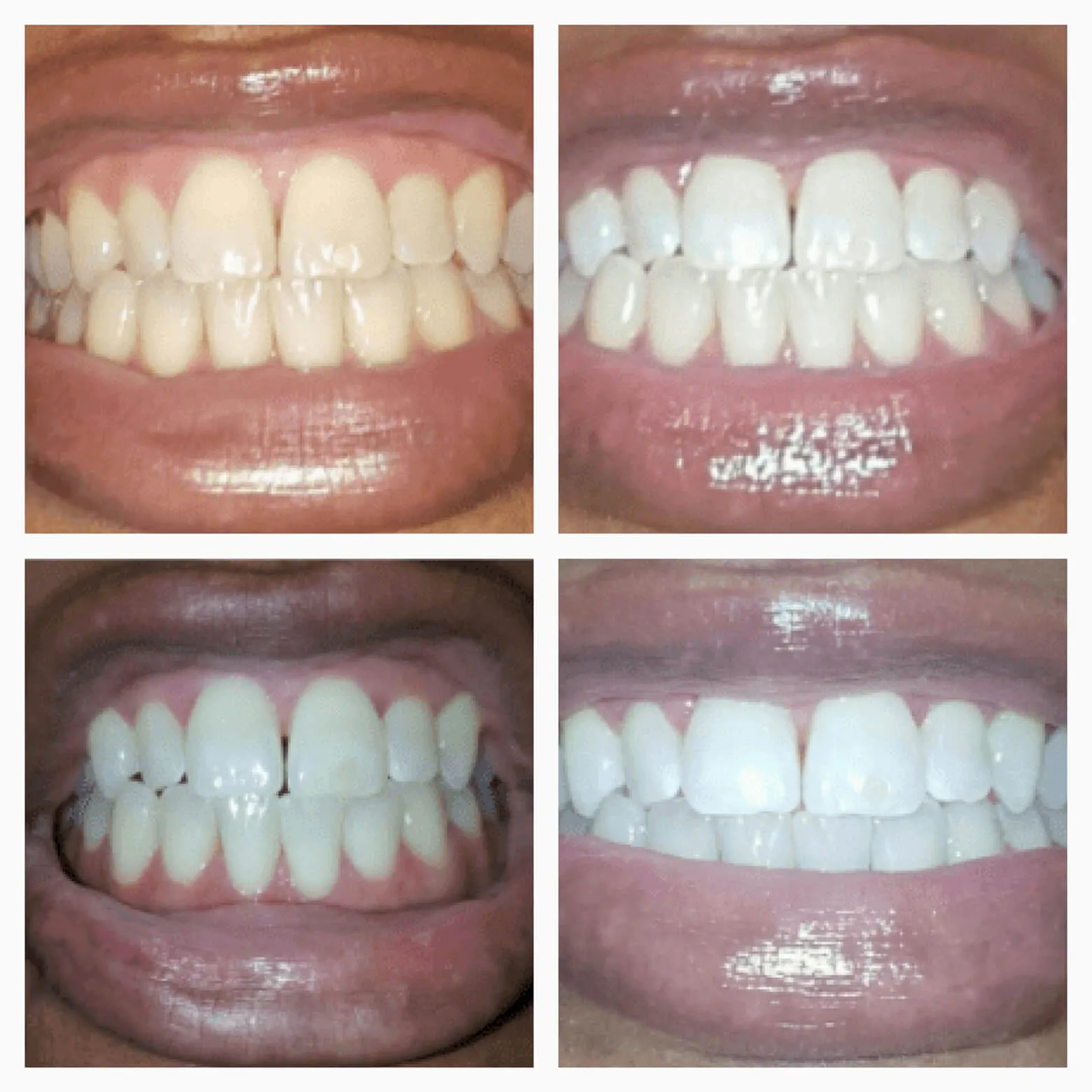 Brighten   Whiten Premium Bundle