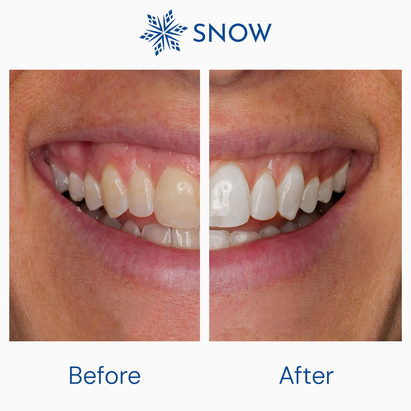 Brighten   Whiten Premium Bundle