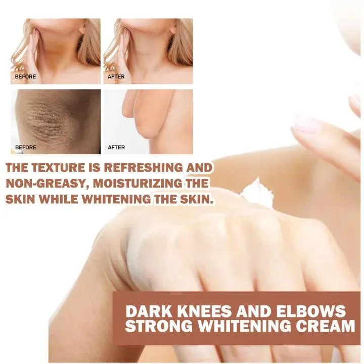 Eelhoe Knees and Elbows Whitening Cream - 50g