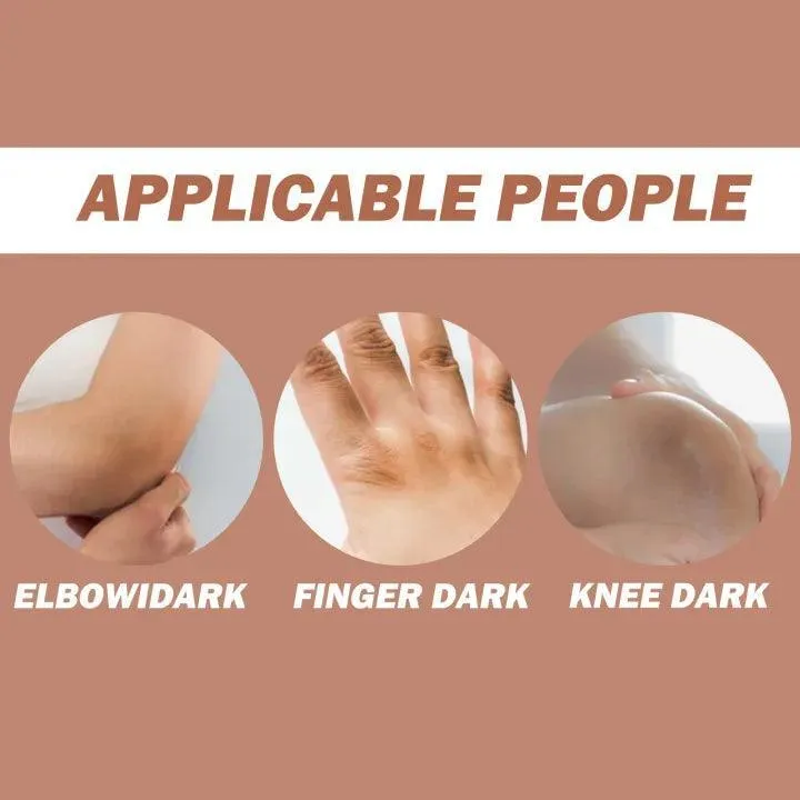 Eelhoe Knees and Elbows Whitening Cream - 50g