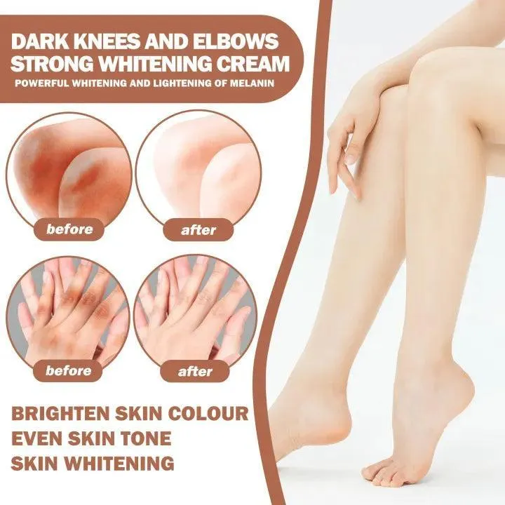 Eelhoe Knees and Elbows Whitening Cream - 50g