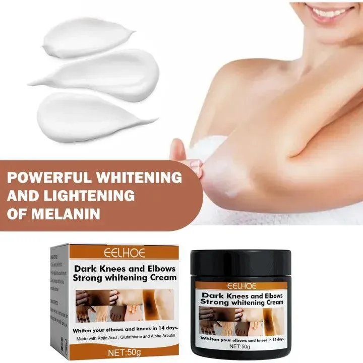 Eelhoe Knees and Elbows Whitening Cream - 50g