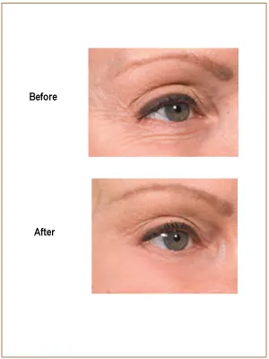 EGGVANCED SKIN THERAPY SYSTEM