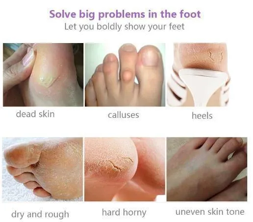 Exfoliating Foot Mask Peels - Remove Calluses & Dead Skin