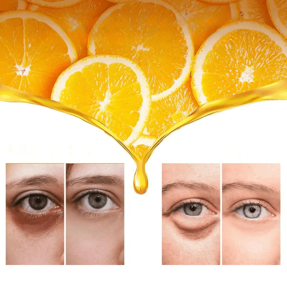 Eye Cream For Dark Circles, 20% Vitamin C, Hyaluronic Acid, Reduces Puffiness & Fine Lines, Moisturizes & Brightens, Unisex, Suitable For Daily Use
