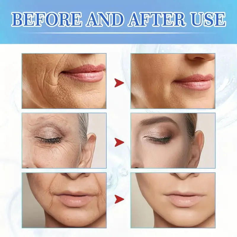 Intensive Anti Aging Botox Facial Serum - Plumps, Firms, Smooths Fine Lines and Wrinkles