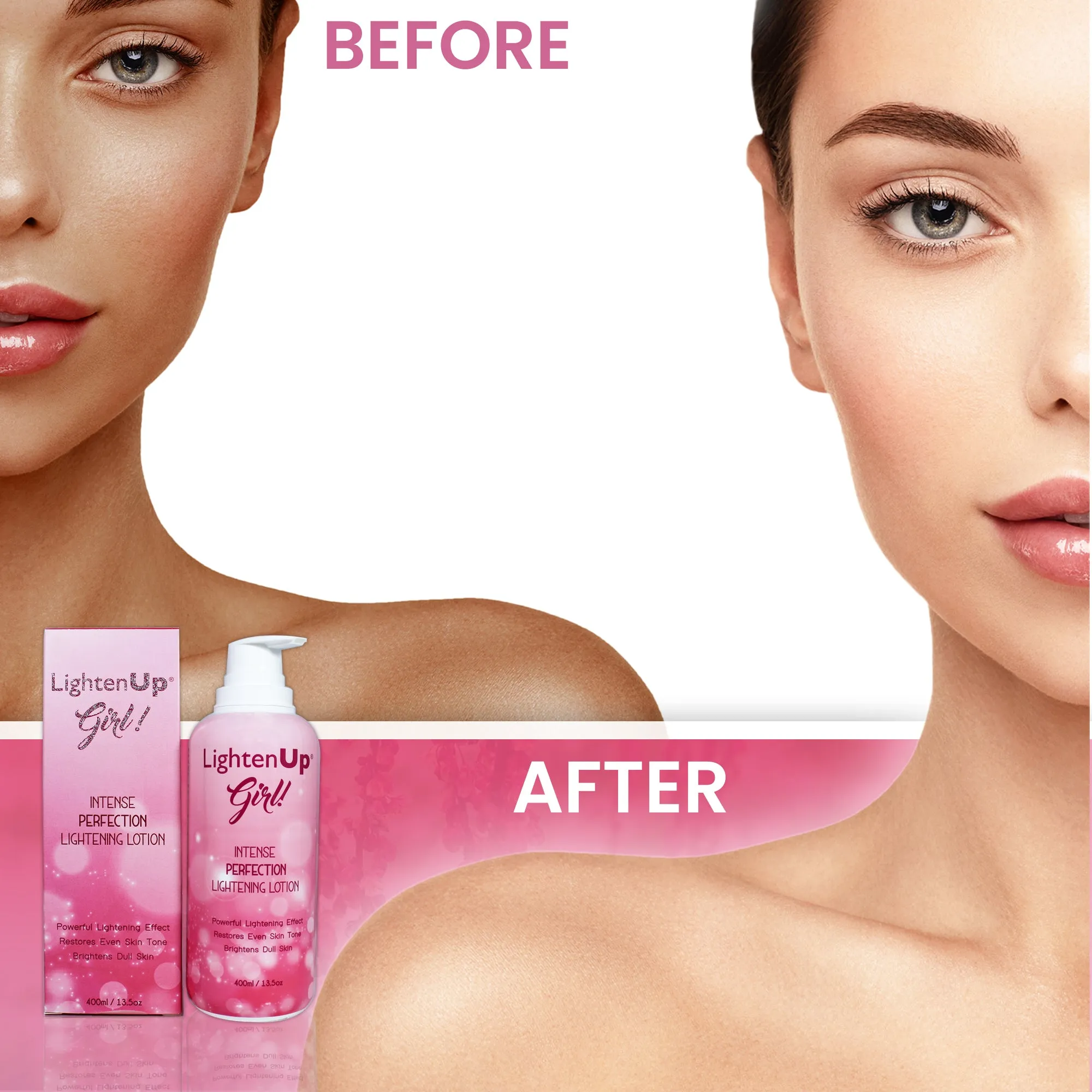 LightenUp Girl! Intense Perfection Lightening Lotion - 400ml / 13.5 Oz