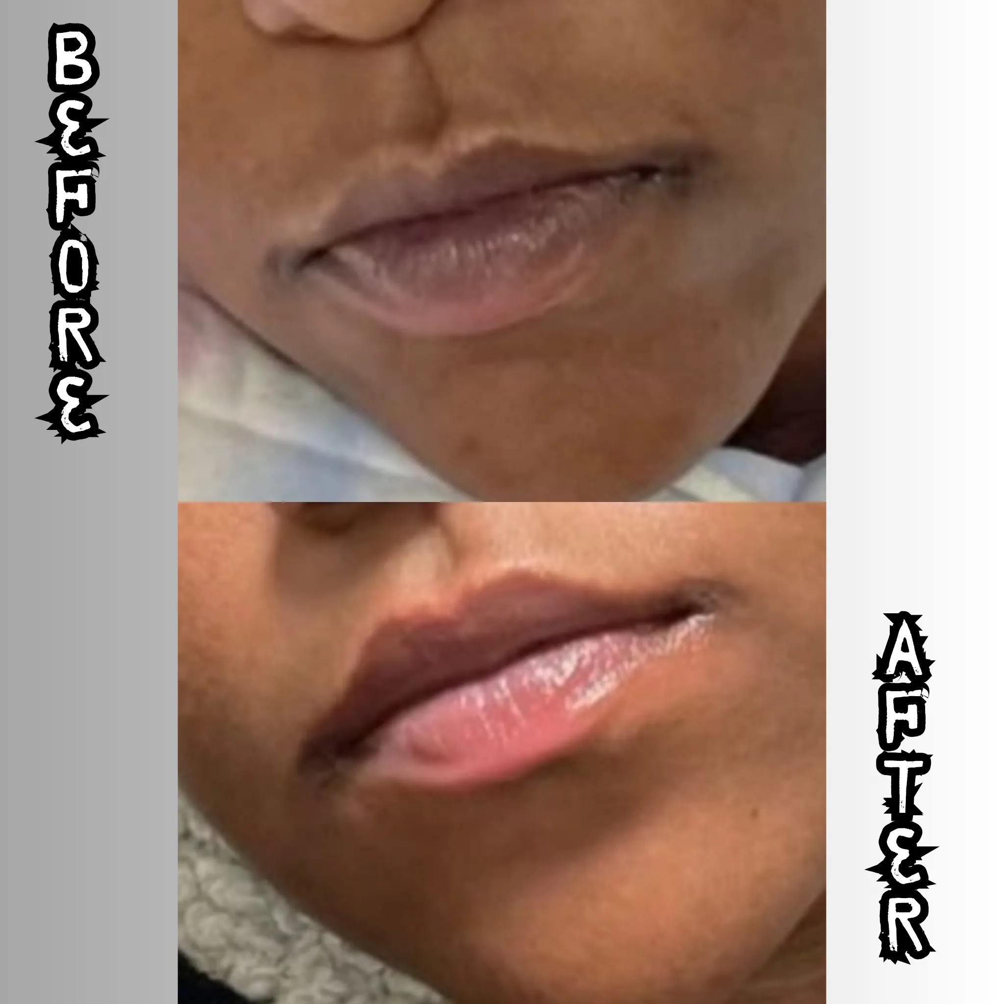 Lip Restoration Kit (For Men)