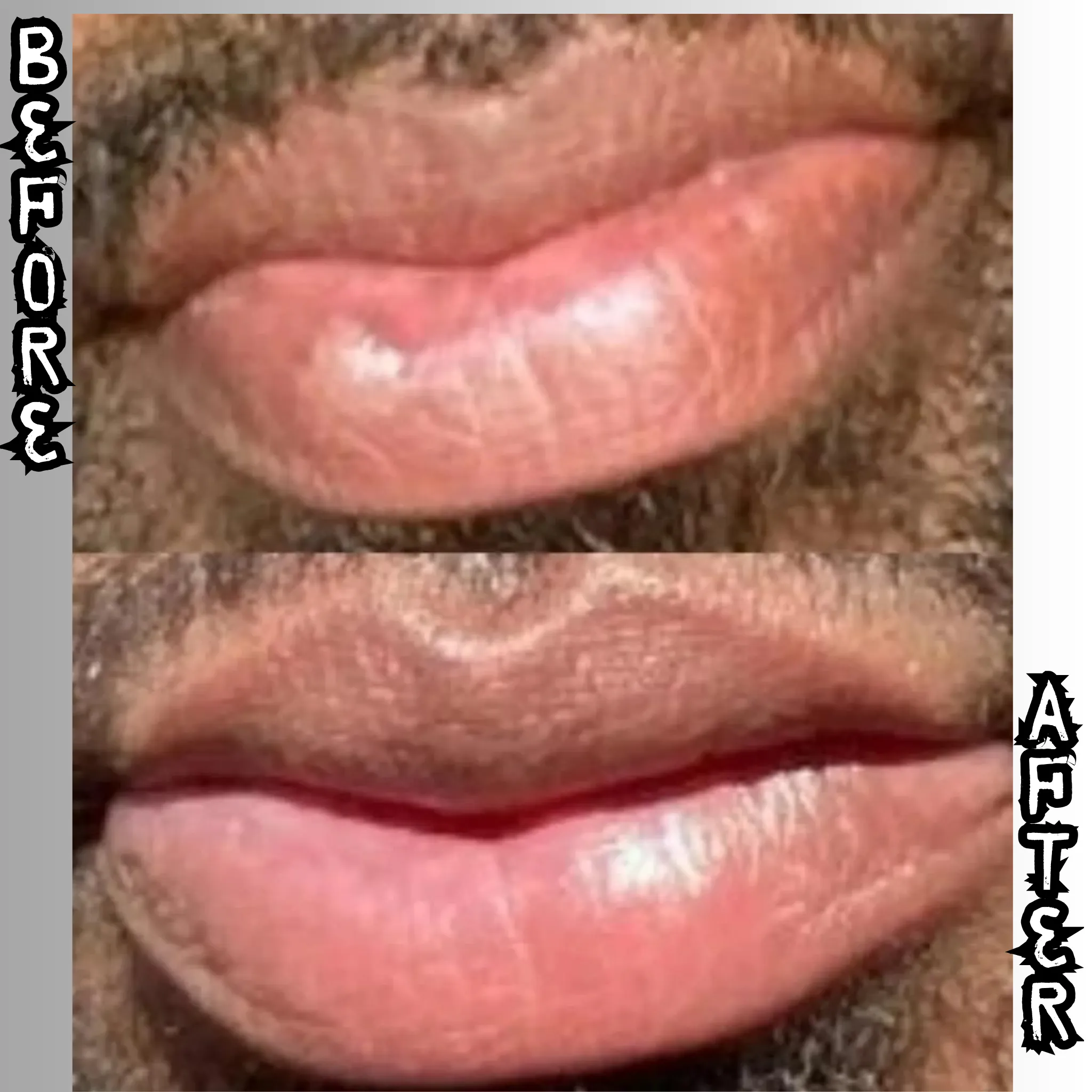 Lip Restoration Kit (For Men)