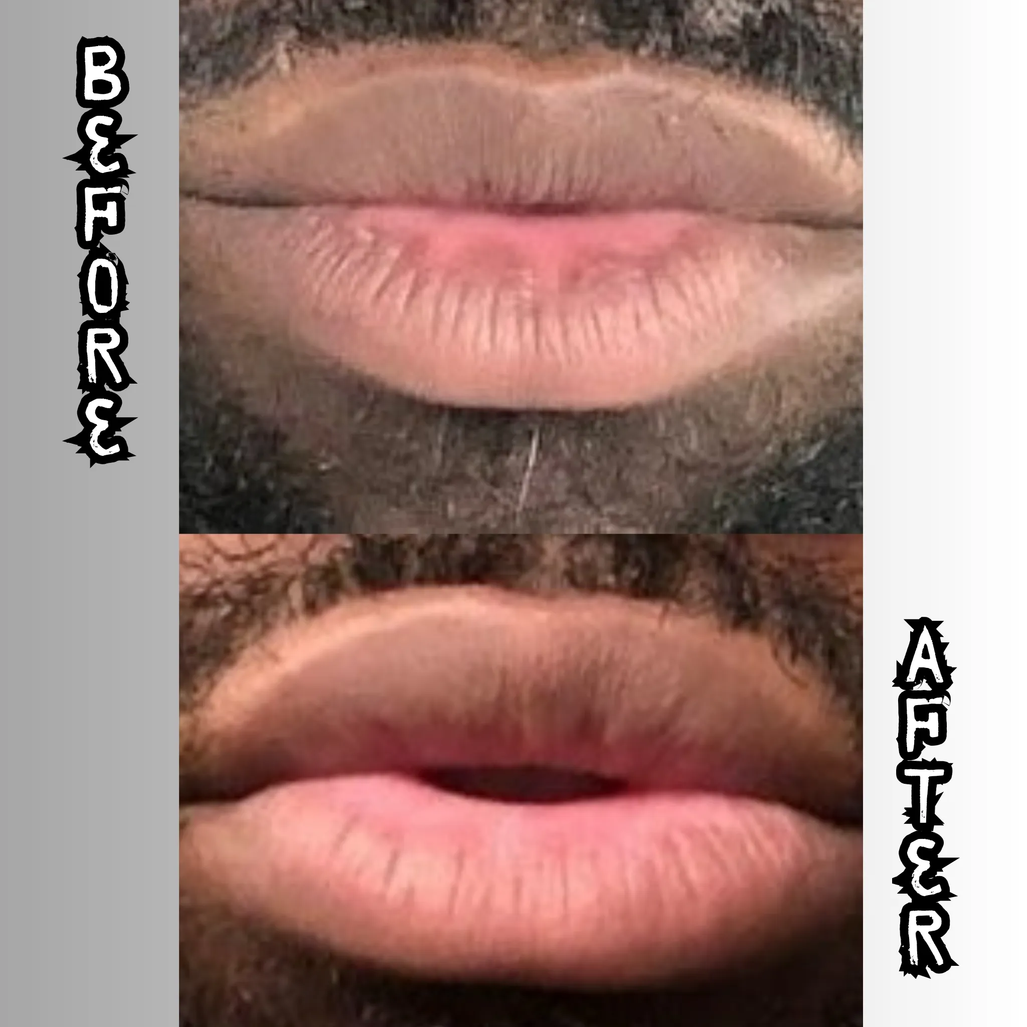 Lip Restoration Kit (For Men)