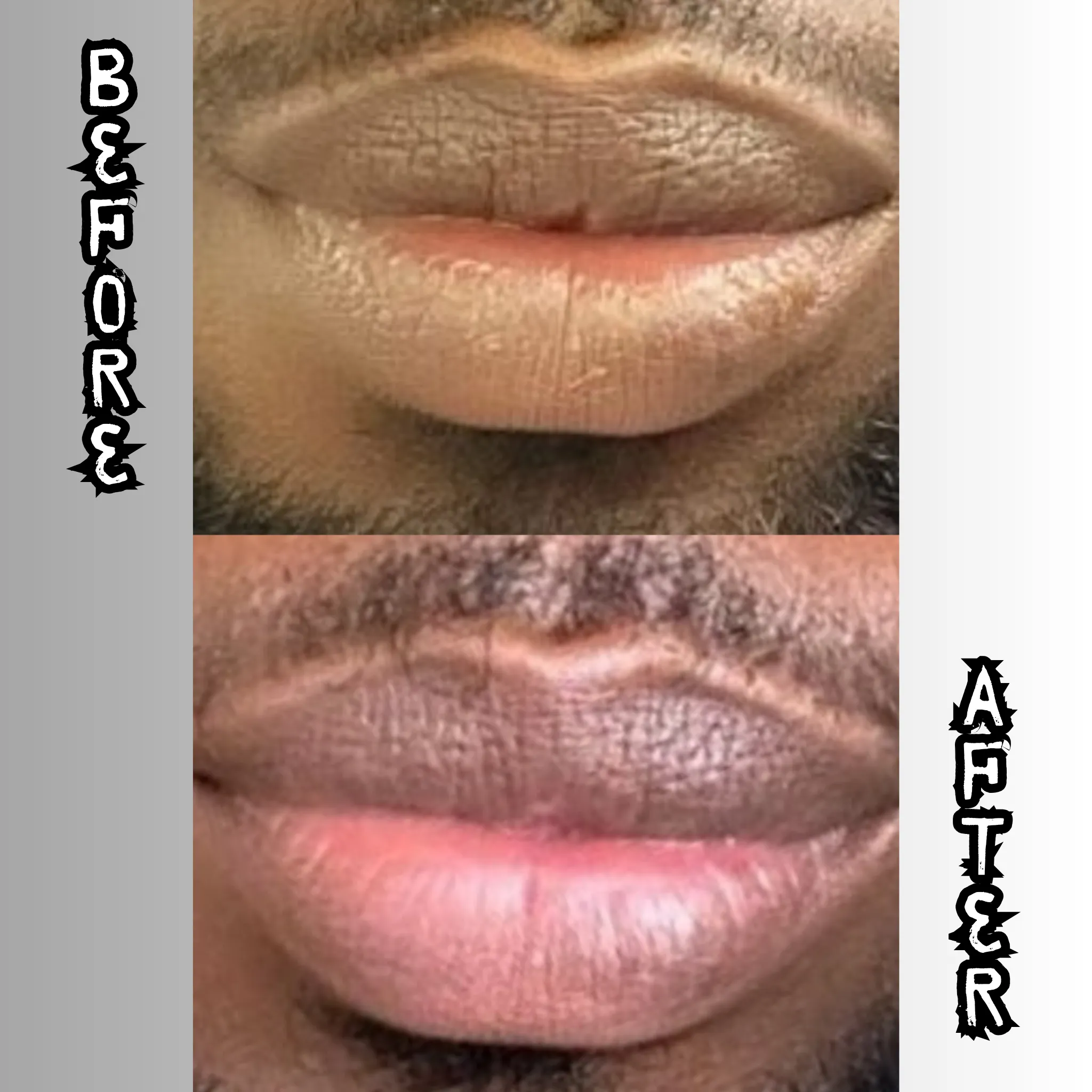 Lip Restoration Kit (For Men)
