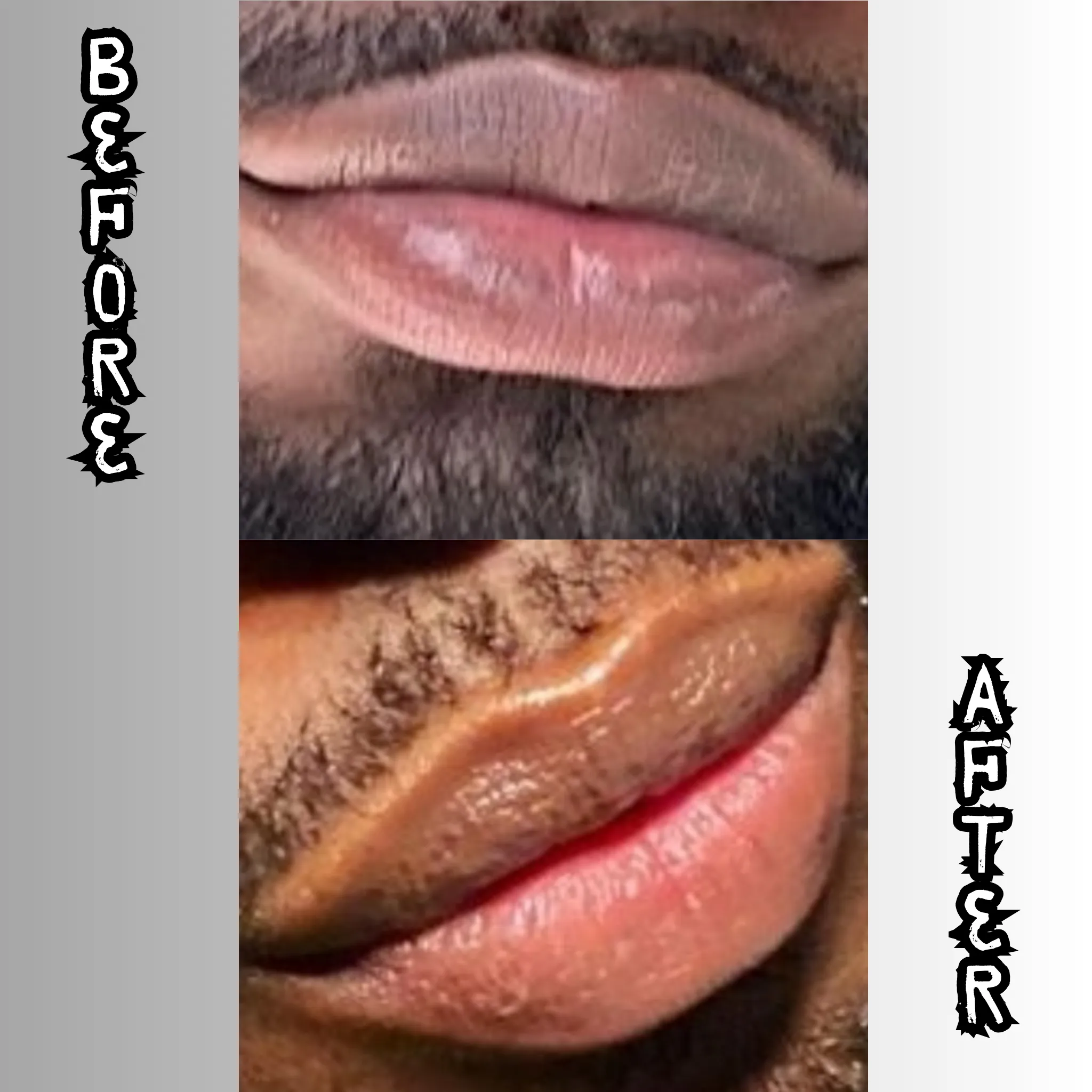 Lip Restoration Kit (For Men)