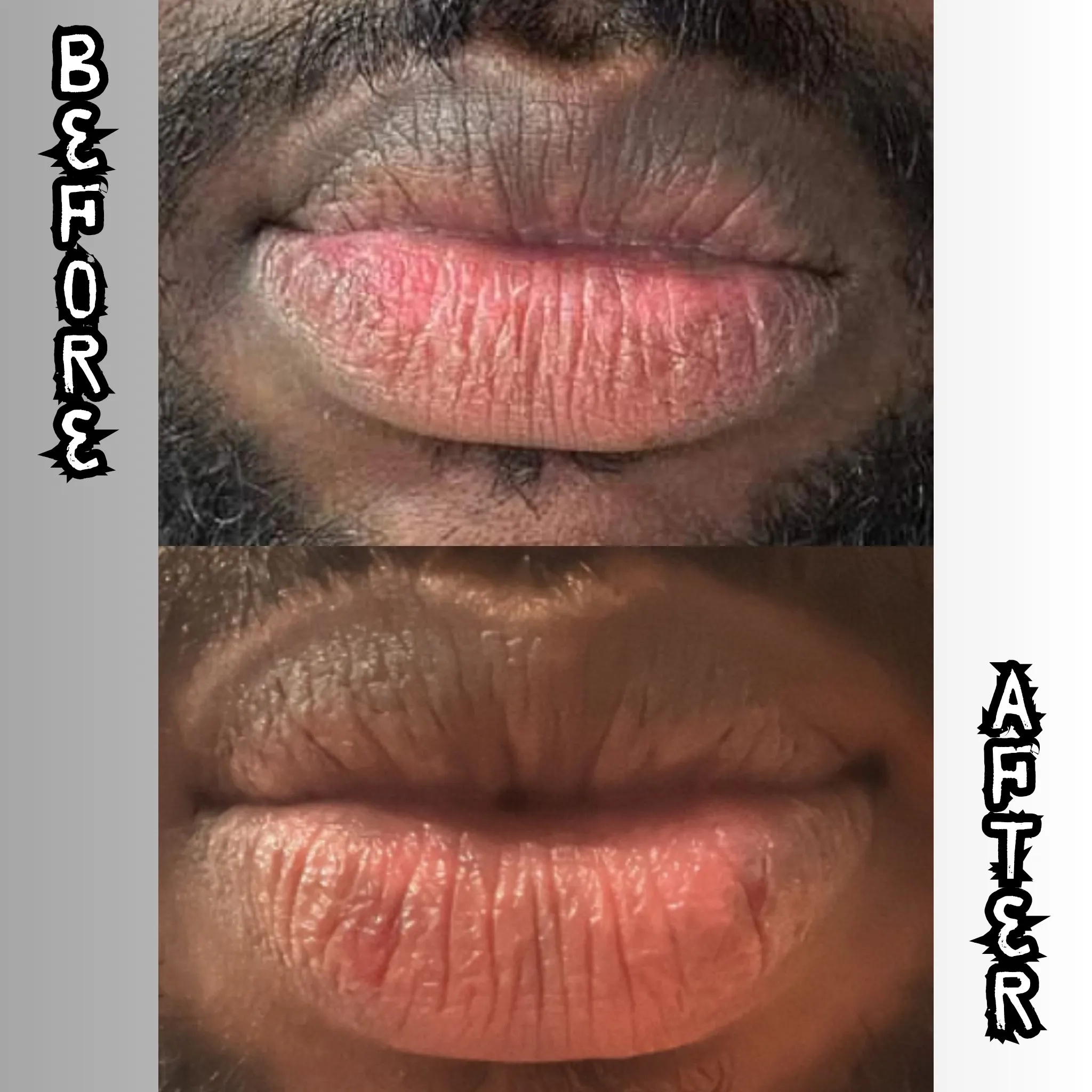 Lip Restoration Kit (For Men)