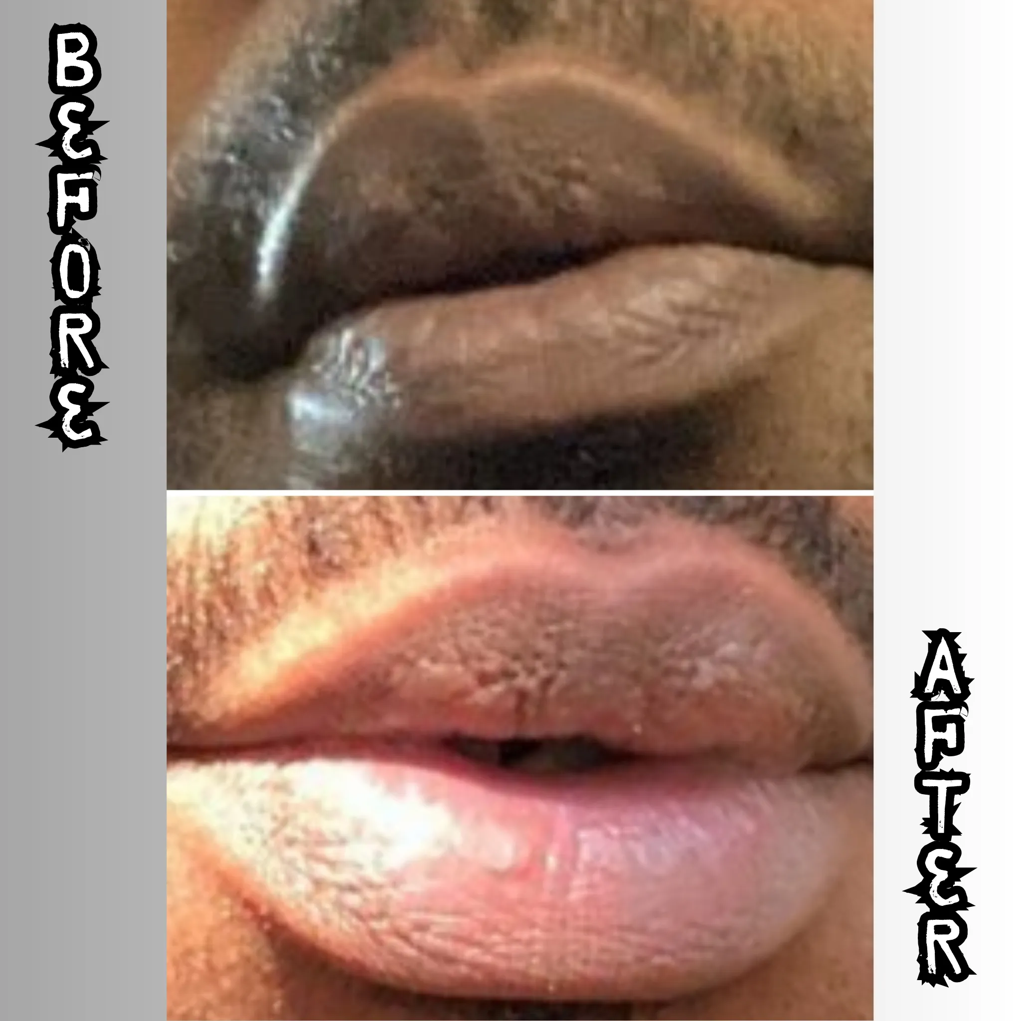 Lip Restoration Kit (For Men)
