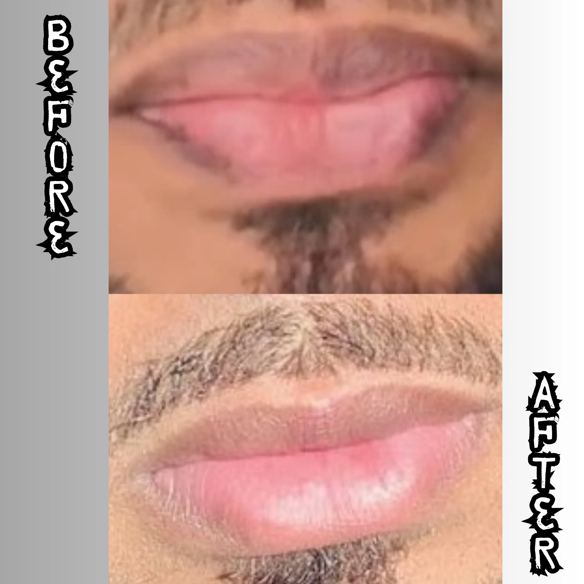Lip Restoration Kit (For Men)