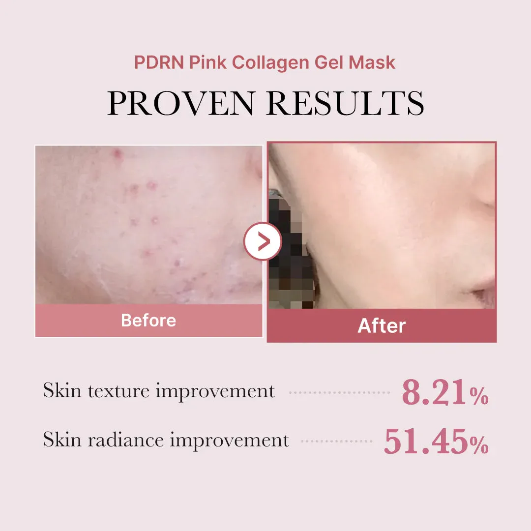 MEDICUBE-PDRN Pink Collagen Gel Mask