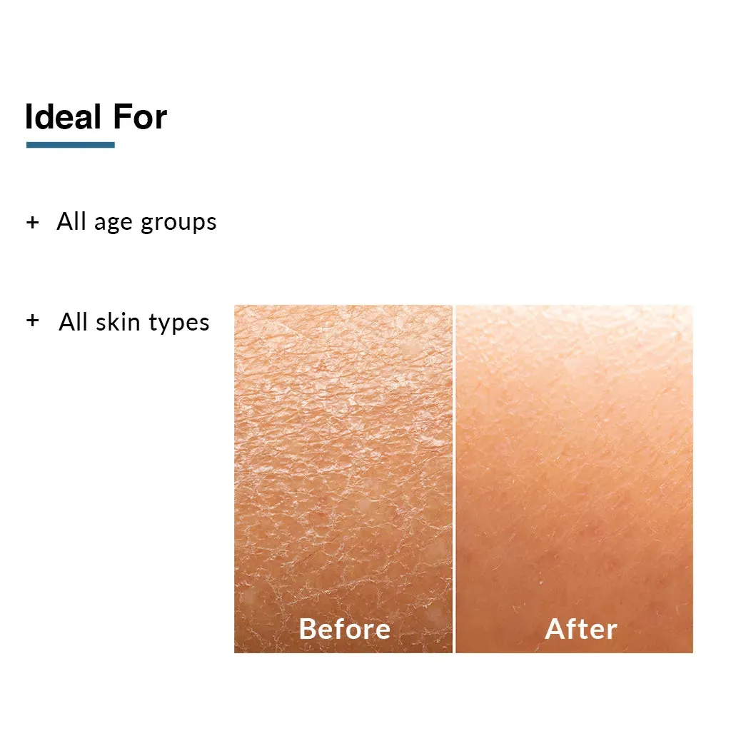Moisturizing Lotion