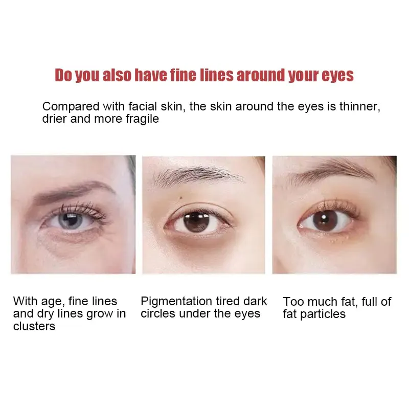 New Anti-Wrinkle O'Cheal Eye Cream