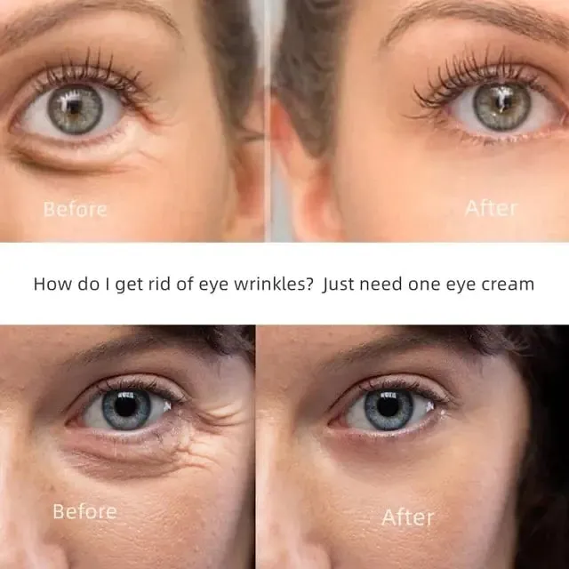 New Anti-Wrinkle O'Cheal Eye Cream
