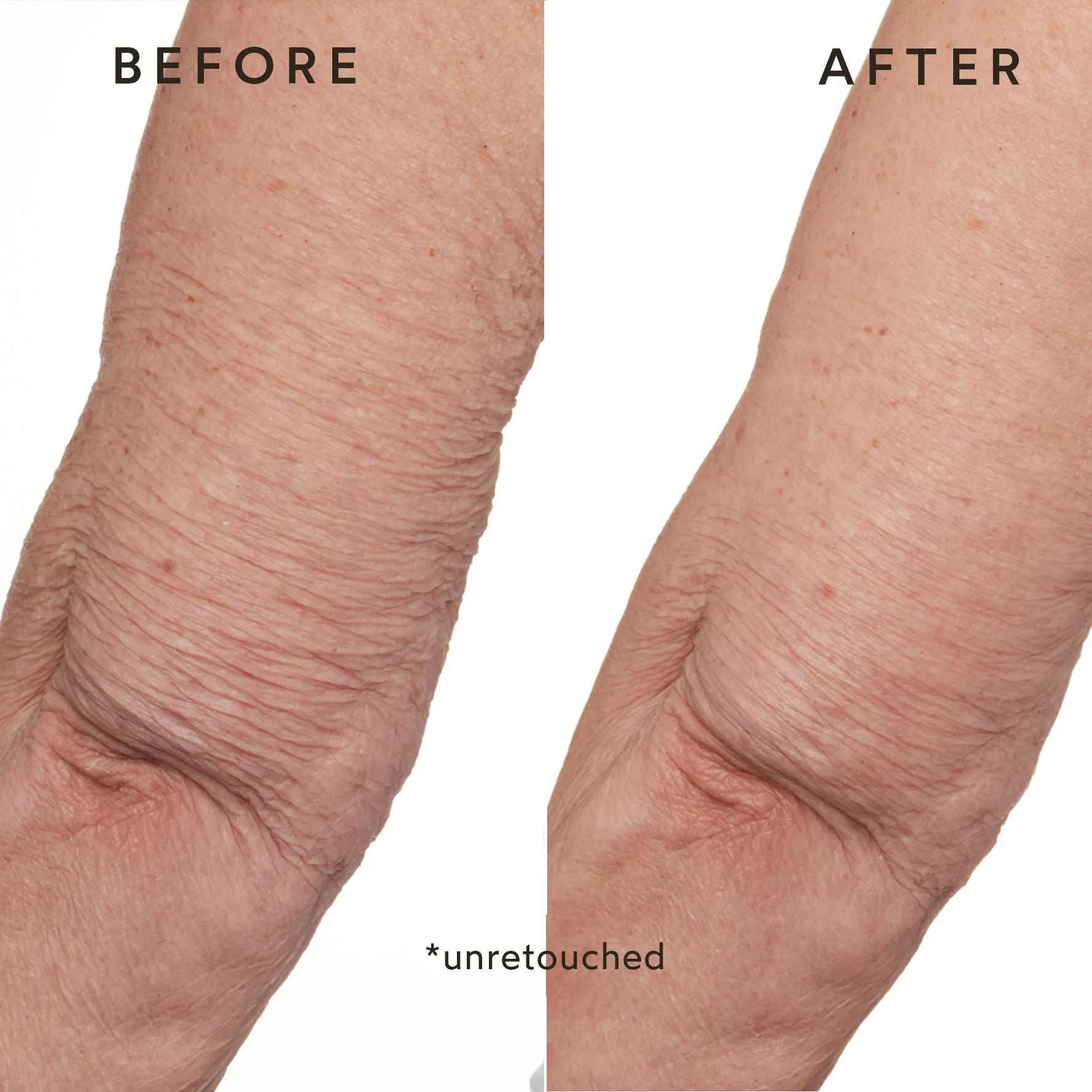 Phyto-Retinol Anti-Aging Body Lotion