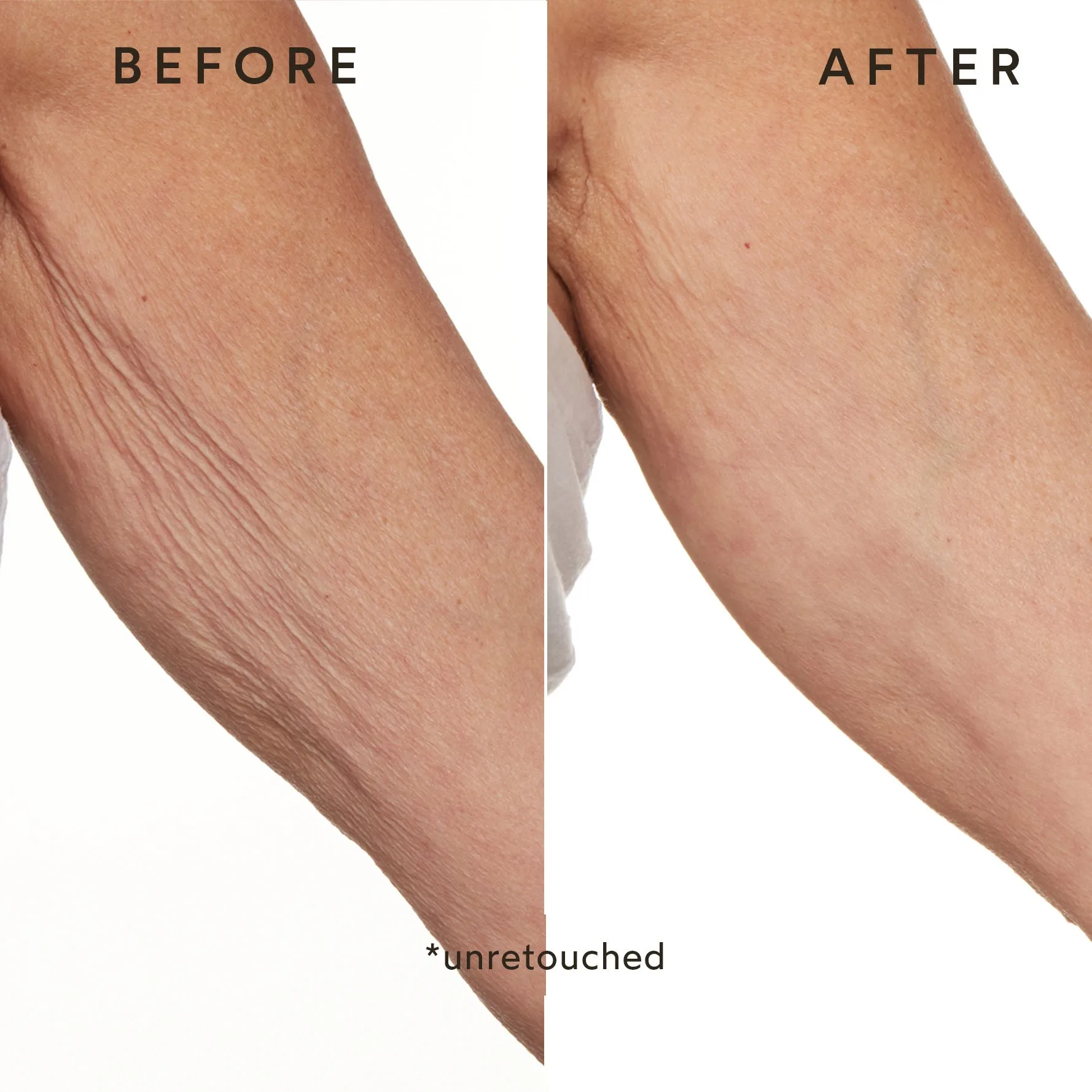 Phyto-Retinol Anti-Aging Body Lotion