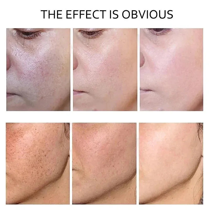Retinol Serum Anti Wrinkle