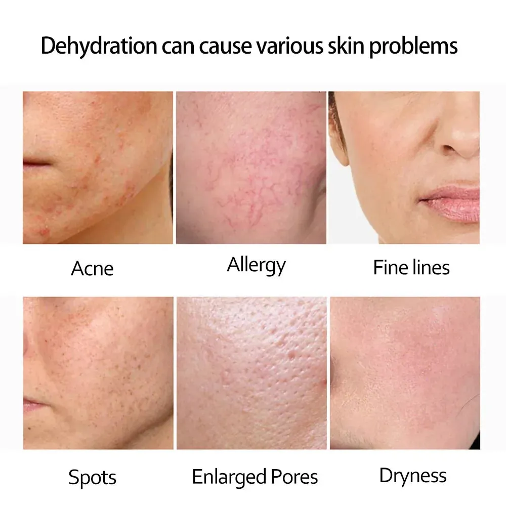 Retinol Serum Anti Wrinkle