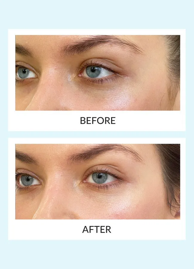 Reusable Eye Therapy Patches Refill