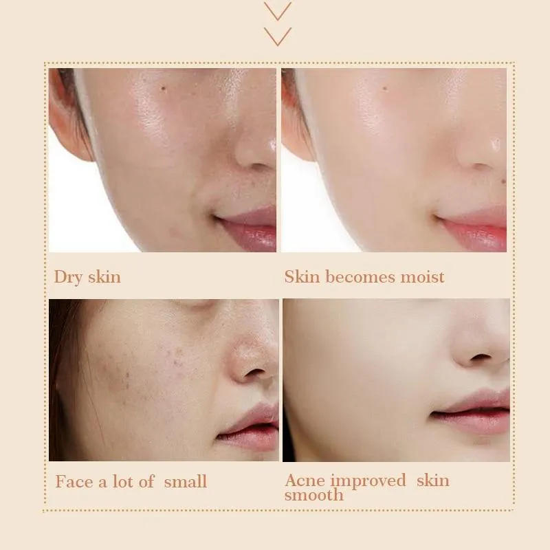 Snail Essence Face Anti Wrinkle Acne Cream Health & Personal Care
