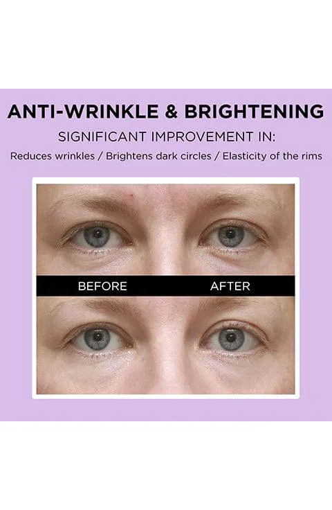 VARI:HOPE Biotics Vital Anti-Aging Eye Cream  20Ml
